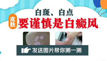 颈部白癜风有哪些典型症状